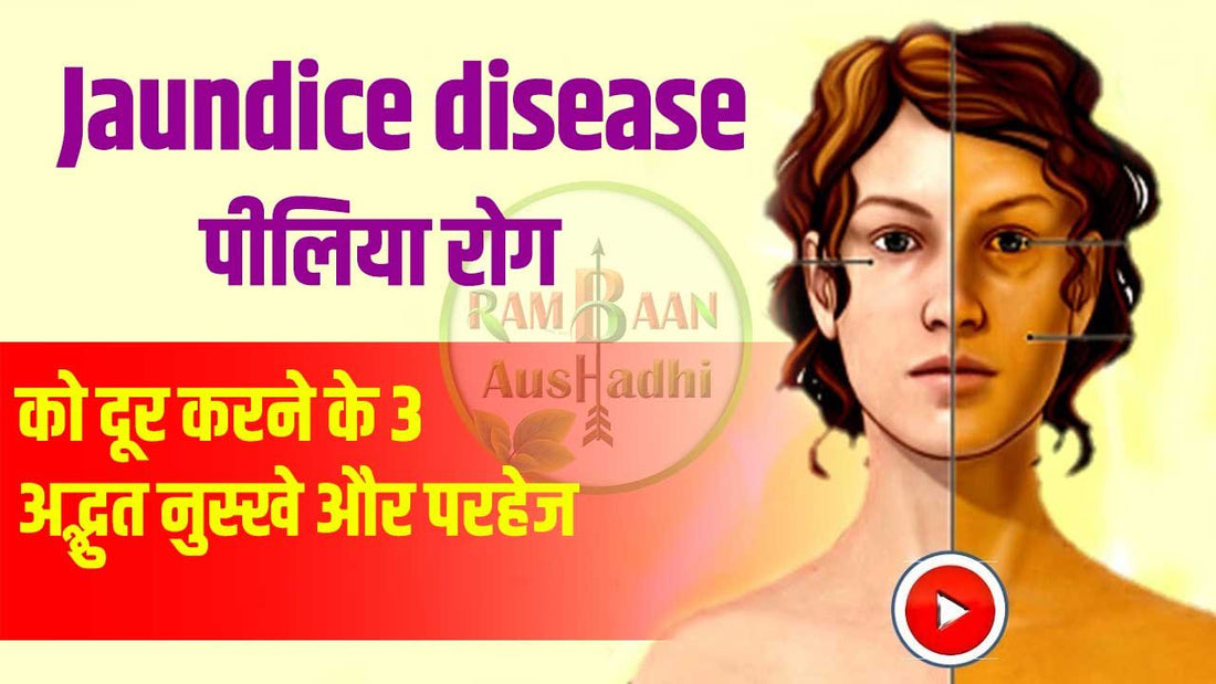 Jaundice-disease