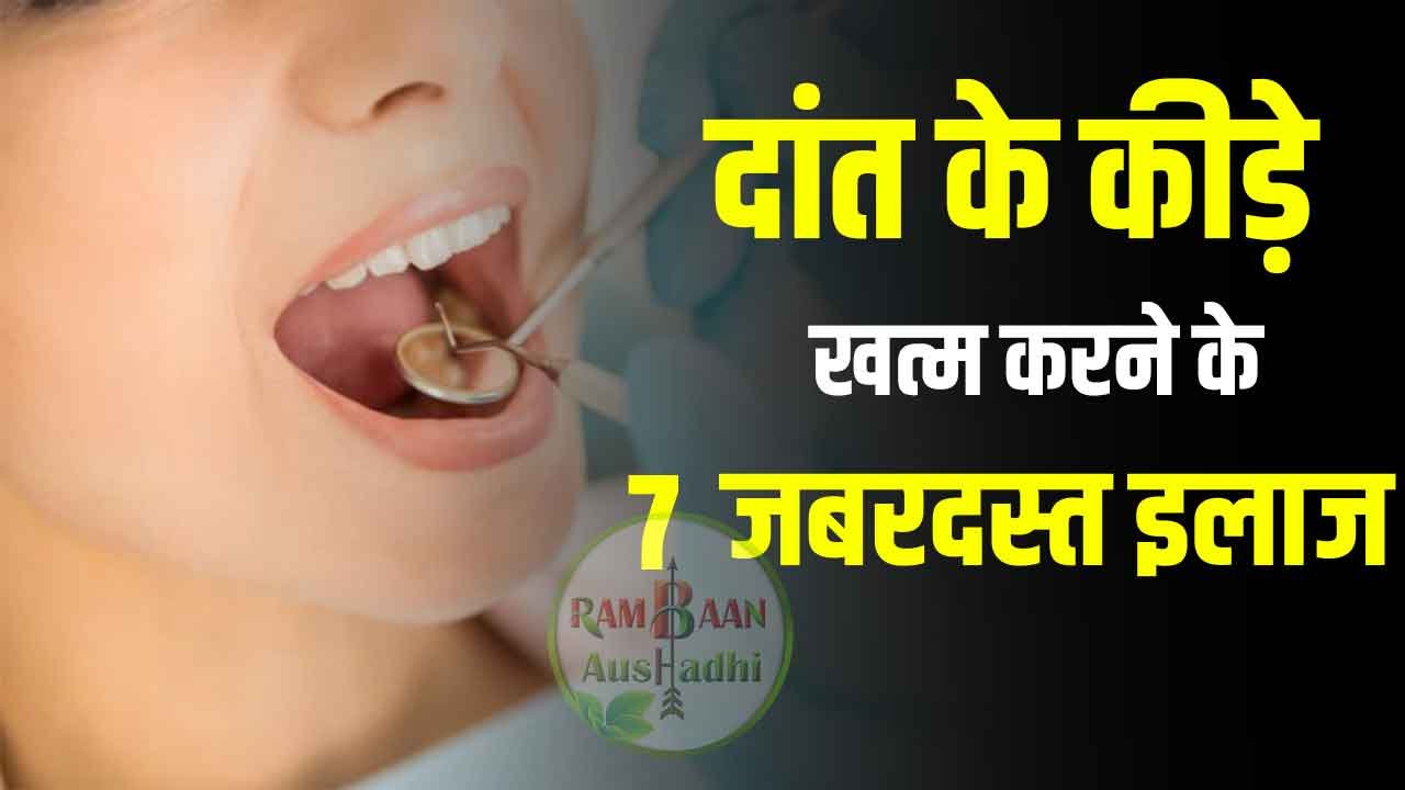 दांत के कीड़े (Tooth worm) खत्म करने के 7 जबरदस्त इलाज Rambaan Aushadhi