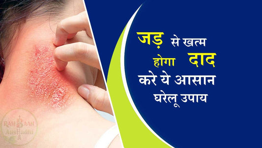 जड़ से खत्म होगा दाद(Ringworm)करे ये 9 आसन से घरेलू उपाय !