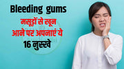 मसूड़ों से खून (Bleeding gums) आने पर अपनाएं ये 16 नुस्खे