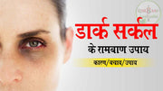 काले घेरों(Dark circles) को दूर करने के घरेलू उपाय
