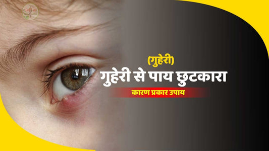 आँखों की पलकों में फुंसी (Guheri) को ठीक करने  के आसान घरेलू उपाय !