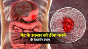 पेट के अल्सर(Stomach ulcers) को ठीक करने के सर्वोत्तम उपाय