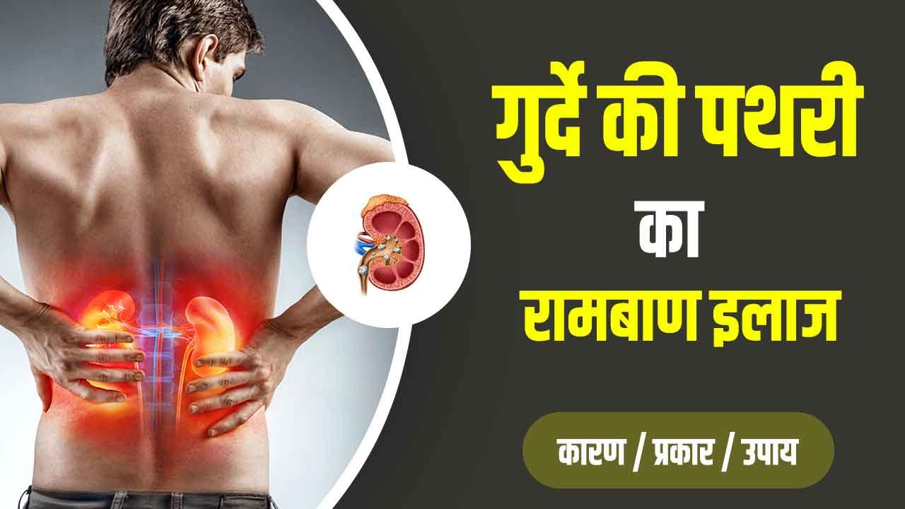 Kidney stones treatment