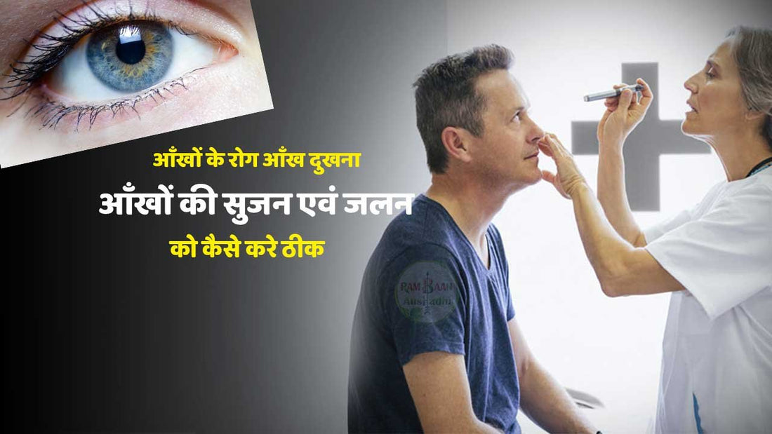 आँखों के रोग आँख दुखना(eyes pain),आँखों की सुजन एवं जलन को कैसे करे ठीक!