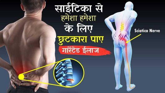 साइटिका (Sciatica)का ऑपरेशन करवाने करवाने की सोच रहे है तो यह जरुर पढ़े