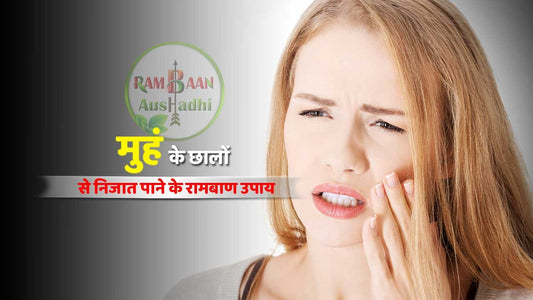 मुँह के छालों(Mouth ulcers) से जल्दी निजात पाने के लिए करे ये 9 उपाय !