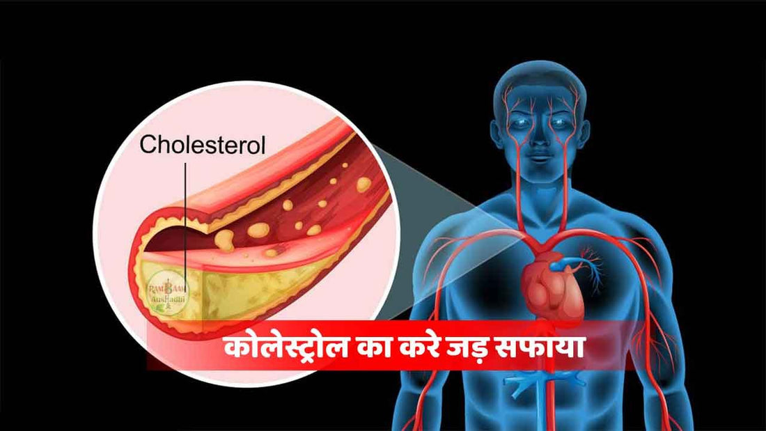 कोलेस्ट्रोल (Cholesterol)का सफाया कीजिये और हार्ट-अटेक,ब्रेन अटेक,लकवा जैसी गंभीर बीमारियों से बचिए