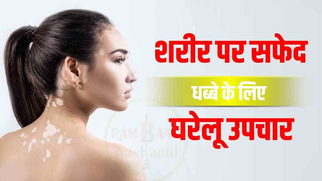 शरीर पर सफेद धब्बे (White spots on the body) के लिए घरेलू उपचार