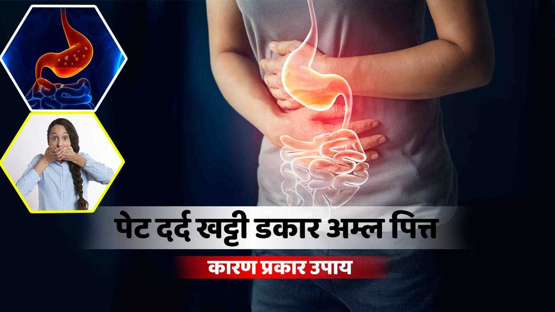 पेट दर्द ,खट्टी डकारें(Indigestion),अम्ल पित्त को कैसे करे ठीक !10 जबरदस्त उपाय