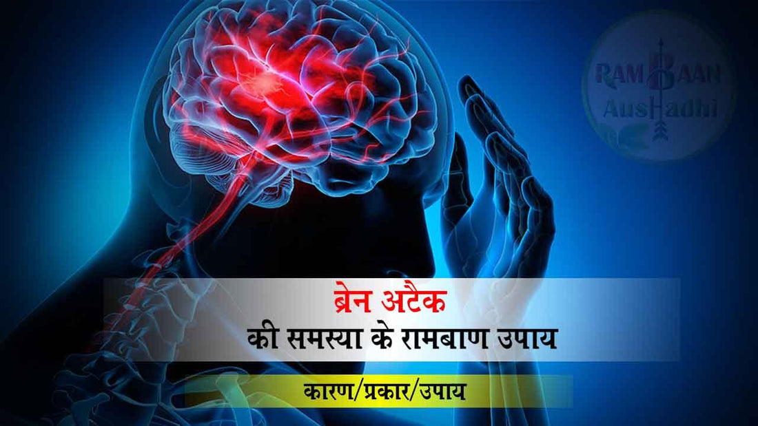 ब्रेन अटैक (Brain attack) से छुटकारा पाने के रामबाण उपाय