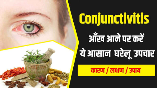 conjunctivitis causes