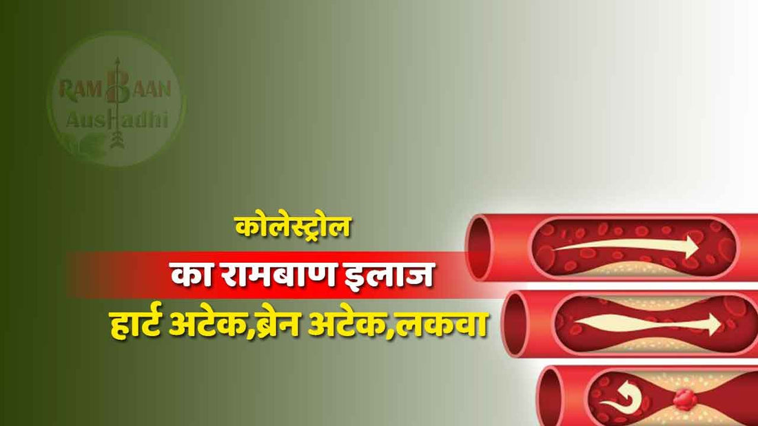 कोलेस्ट्रोल (Bad cholesterol)का सफाया कीजिये और हार्ट अटेक,ब्रेन अटेक,लकवा जैसी गंभीर बीमारियों से बचिए