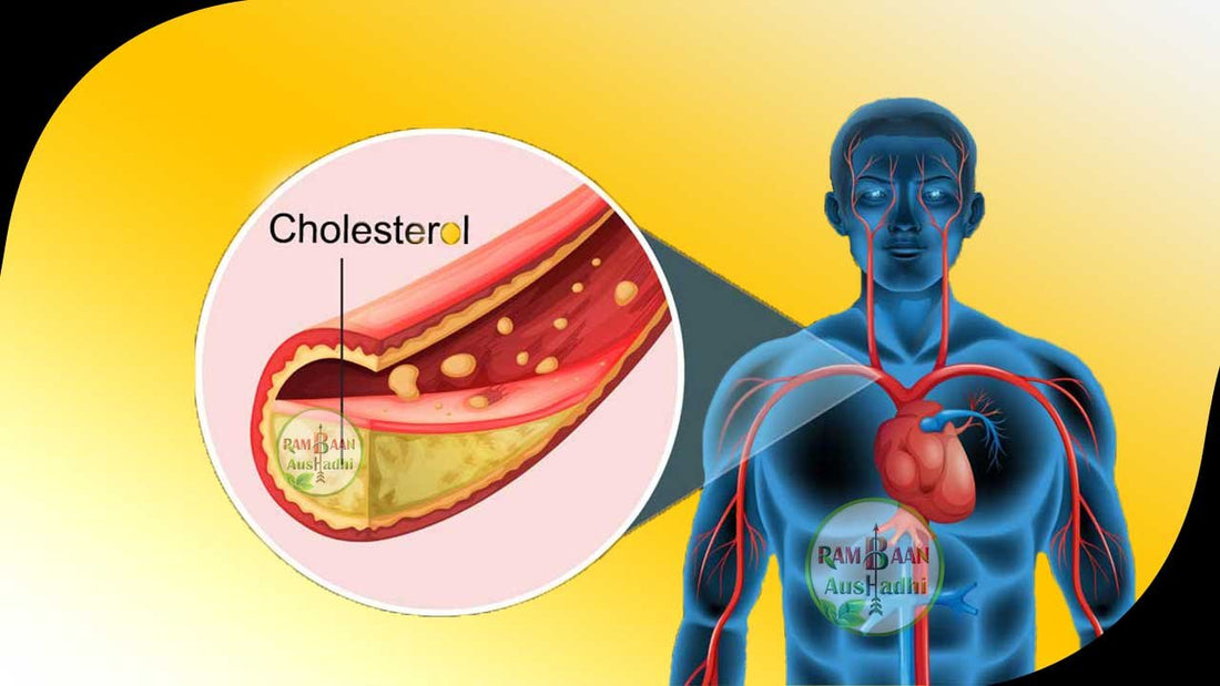 Cholesterol problem