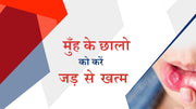 मुँह के छालों (Mouth ulcers)को करें जड़ से खत्म