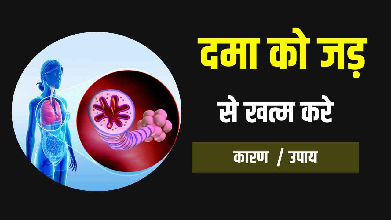 treatment of asthma
