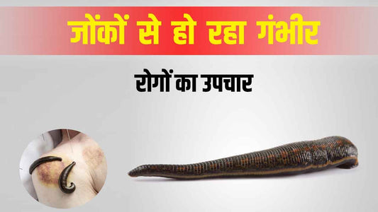 treatment of leeches